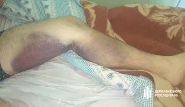 6 поліцейських підозрюються у катуванні громадянина в службових кабінетах Миколаївської поліції (ВІДЕО)
